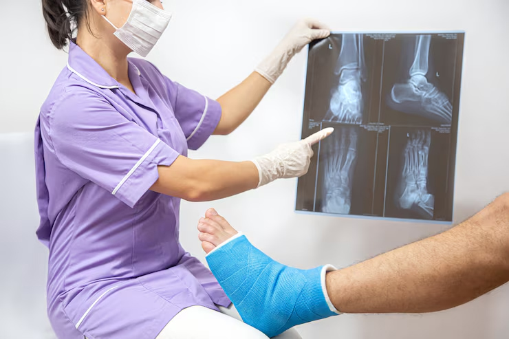 Joint Replacement Surgery